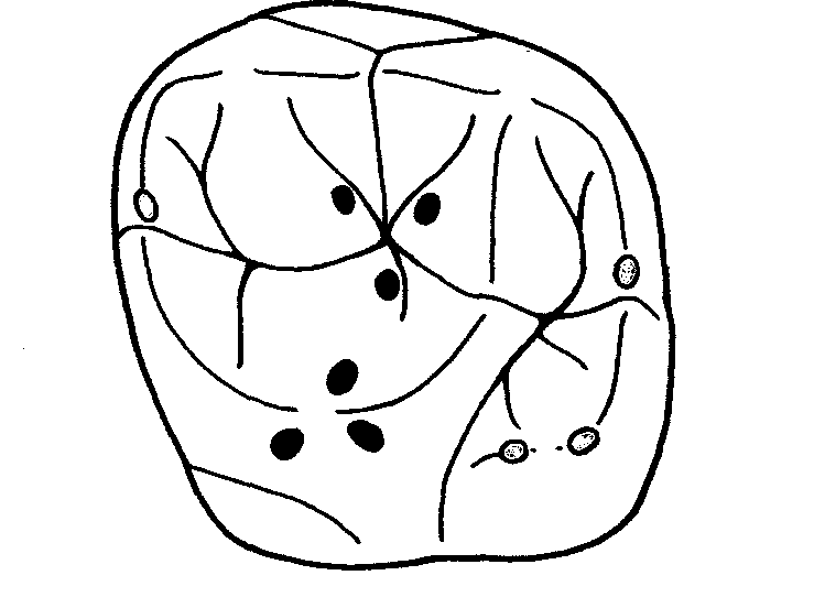 Верхний левый первый моляр